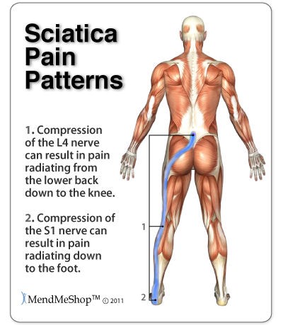 Lower Back Injuries, Common Injuries