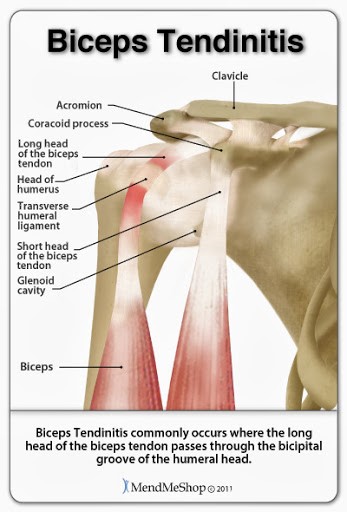 The 3 Most Common Shoulder Injuries from Working Out - High Mountain  Orthopedics