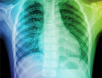 X-rays – Are They Safe? by Sharron Horton