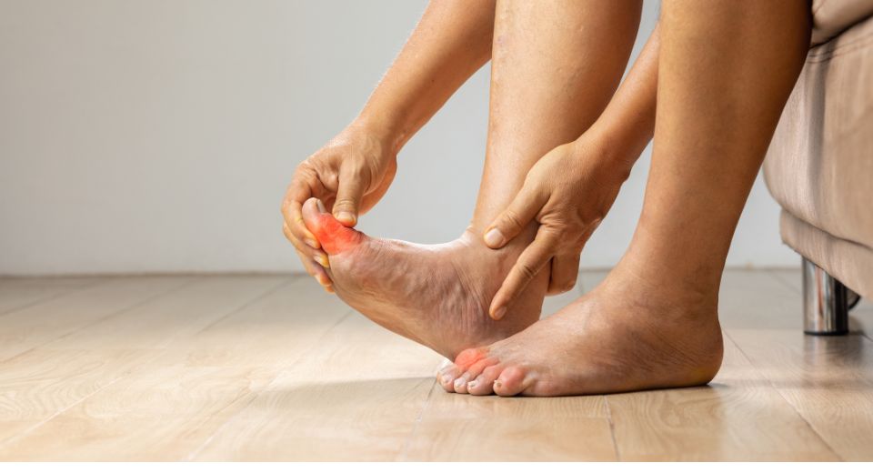 Picture of a person holding onto big toe, which is symptom and sign of gout.